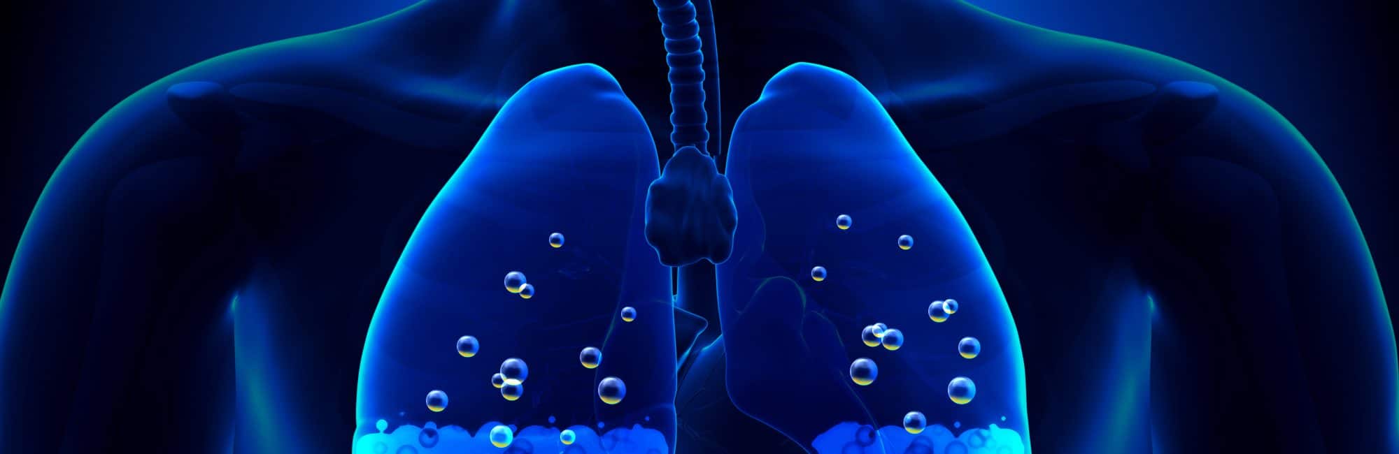 œdème pulmonaire de haute altitude